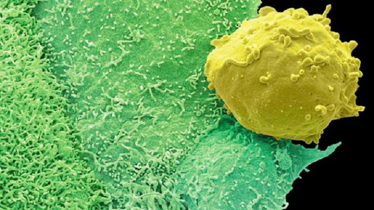 DNA HOSPITALAR - Terapia experimental reverte câncer de próstata avançado