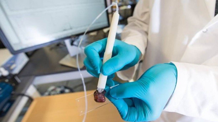 DNA HOSPITALAR - A caneta que consegue identificar um câncer em 10 segundos