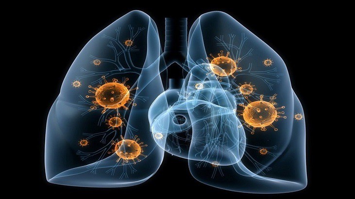 DNA HOSPITALAR - Pesquisadores desenvolvem 'vacina inteligente' e abrangente contra a pneumonia